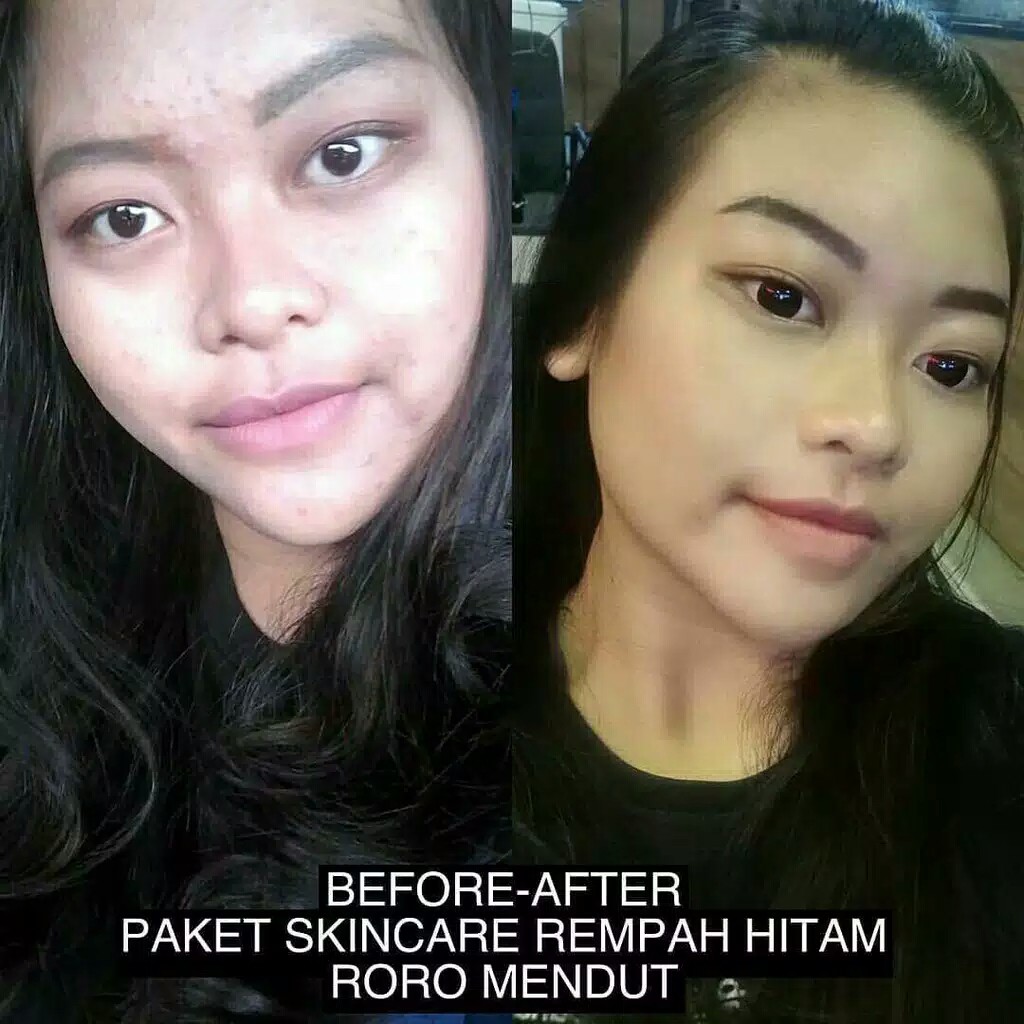 Roro Mendut Starter Rempah Hitam Whitening