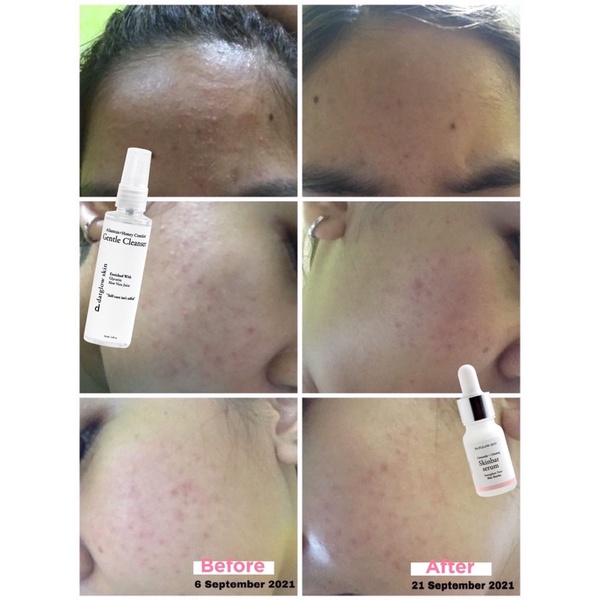 ✨Up Your Look✨ Gentle cleanser facial wash 60ml datglowskin datglow skin