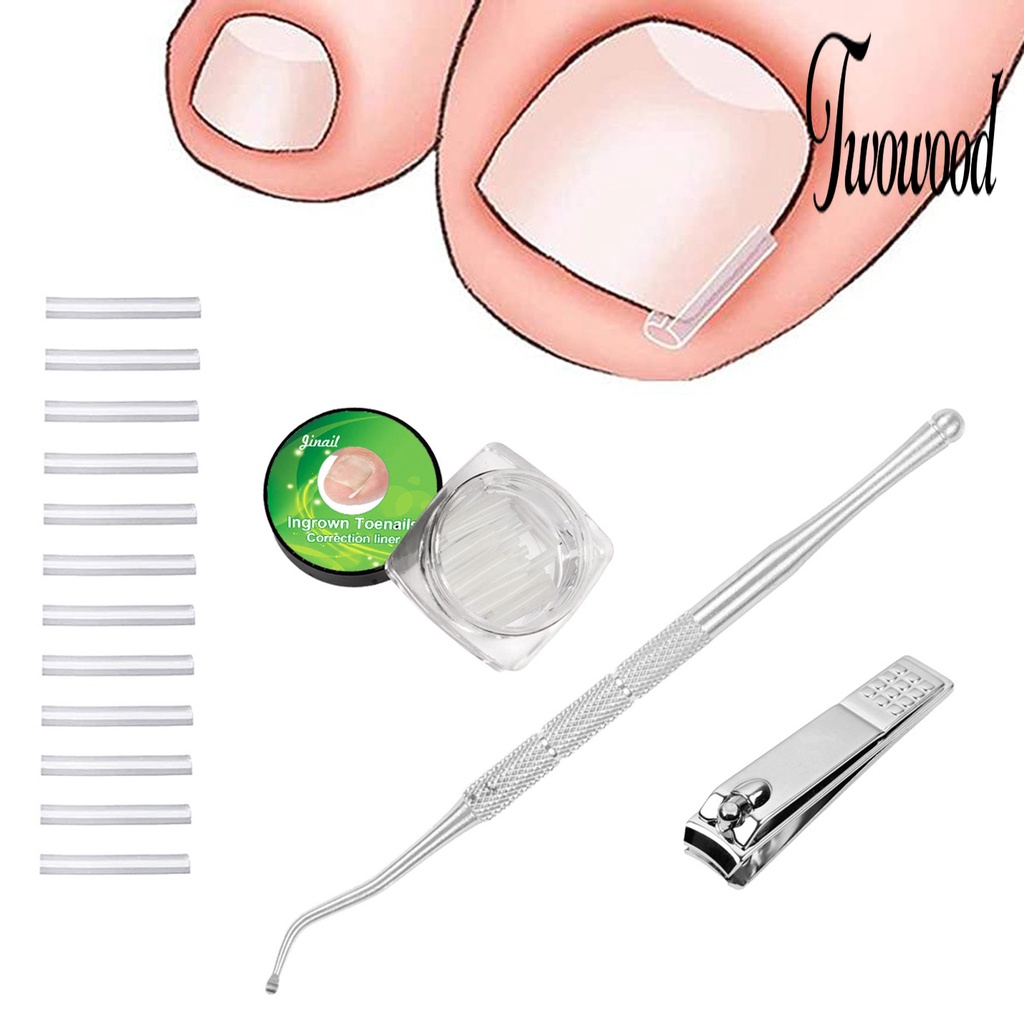 Twowood 1 Set Alat Perawatan Kuku Kaki Ingrown Bahan Stainless Steel Adjustable