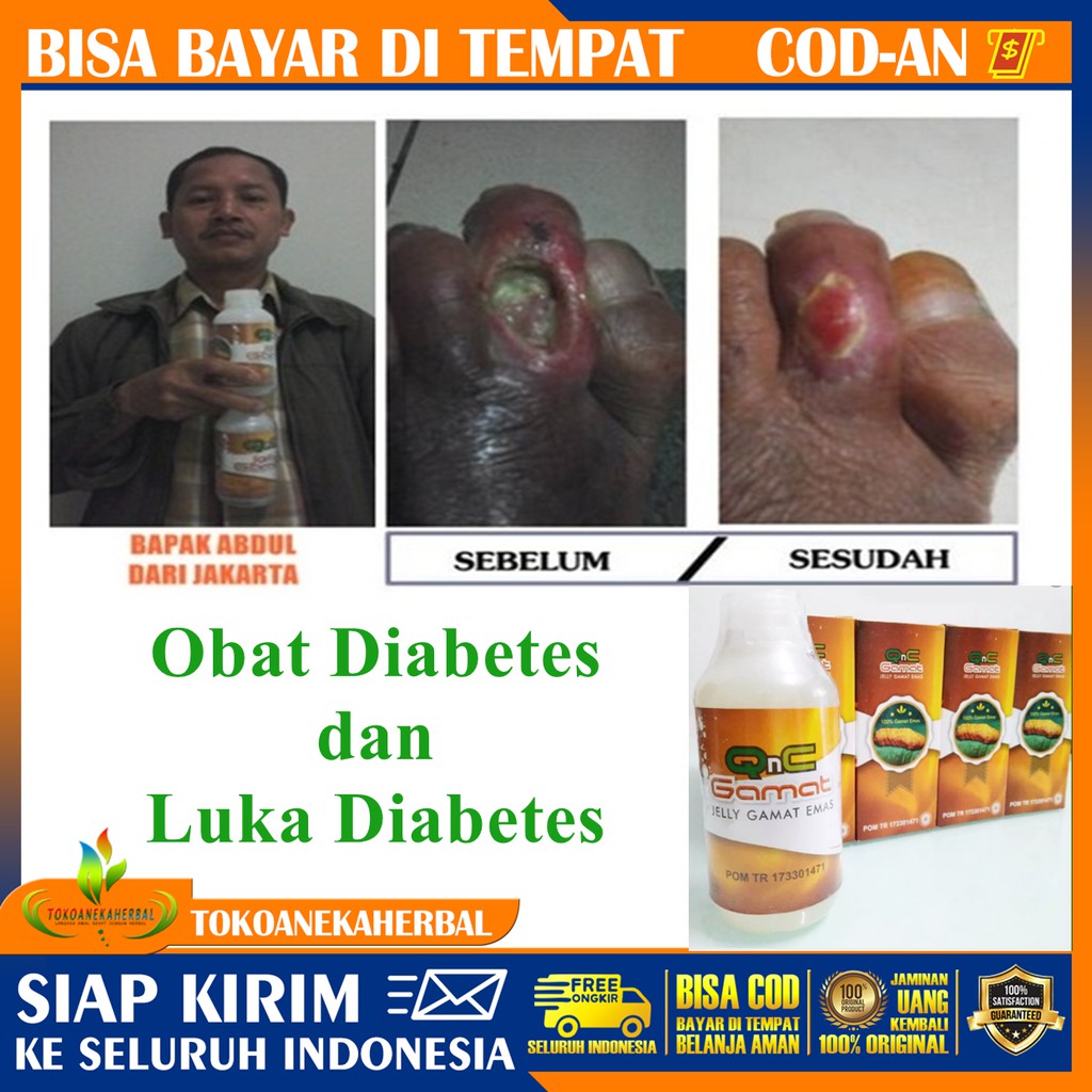 Obat Diabetes Luka Diabetes Obat Kencing Manis Obat Gula Darah Luka Gngreen - Jelly Gamat