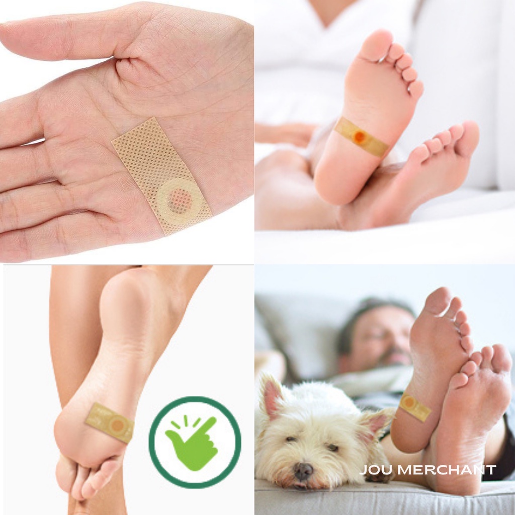 Super Plaster Mata Ikan - Obat Kutil / Callus Remover - Free Hadiah Bonus