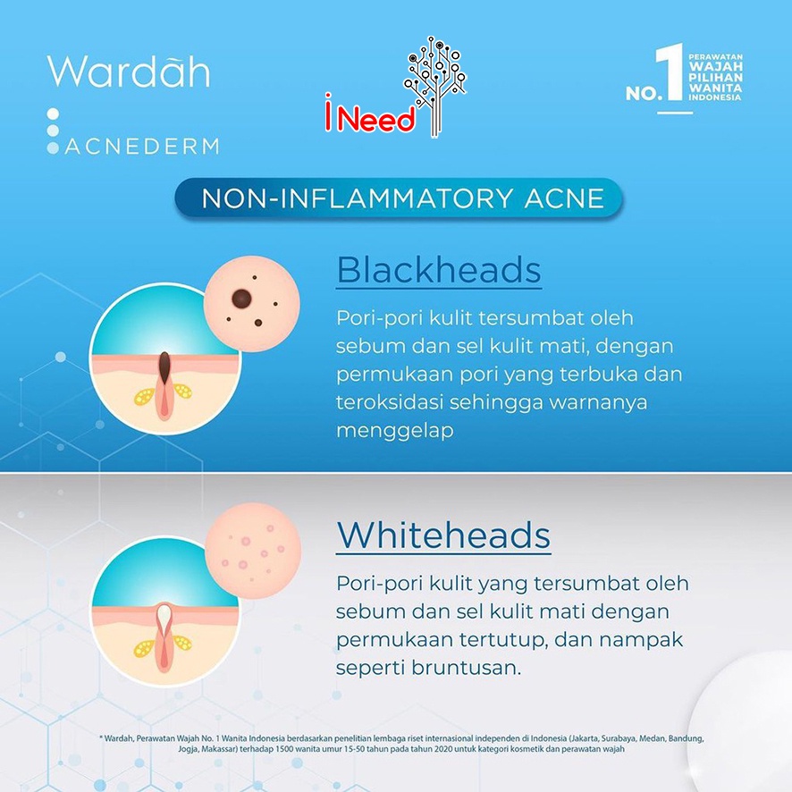 (INEED) WARDAH Acnederm Series | WARDAH ACNEDERM Mengatasi Jerawat Dan Bekas Jerawat - WARDAH ACNE DERM