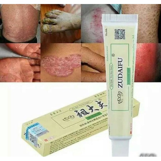 Zudaifu Salep Gatal Gatel Alergi Kulit  Eksim  Kurap Jamur-1