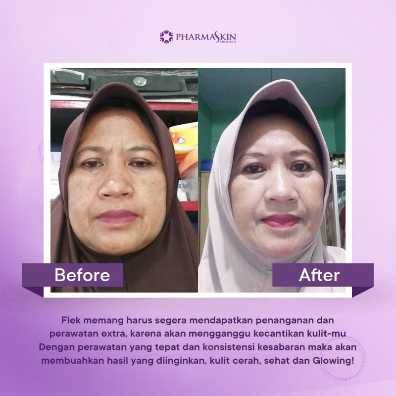 Pharmaskin Paket Skincare Intensive Night Cream Flek Hitam Menahun Perawatan Wajah Menghilangkan Noda Hitam Resmi Halal BPOM Ampuh Original-1