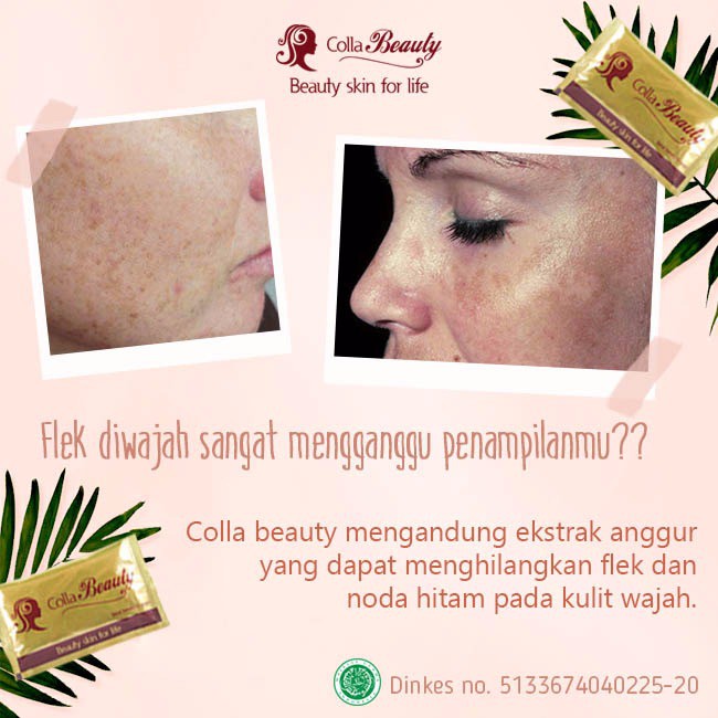 Cara Membedakan Colla Beauty Asli Dan Palsu Tips Membedakan