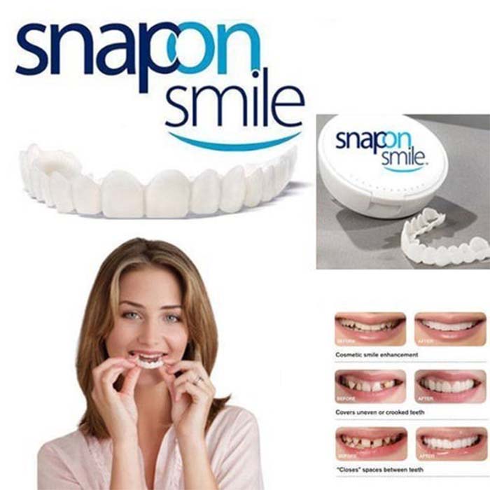 Snap On Smile Gigi Palsu 1 Set Atas Bawah - Gigi Palsu Silikon