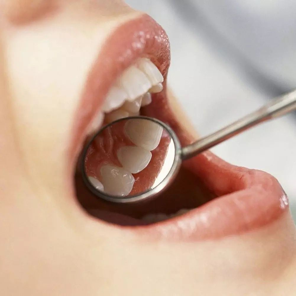 Cermin Mulut Dental Mirror Multifungsi Pegangan Baja Tahan Karat Alat Koreksi Ekstensi Karang Pemutih Gigi F665