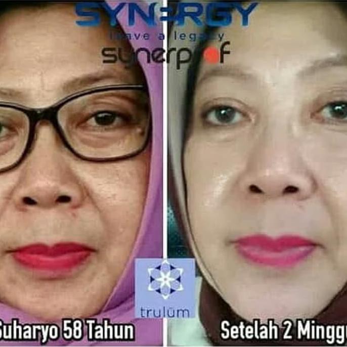 Trulum 15ml Penghilang Flek Hitam dan Kerutan