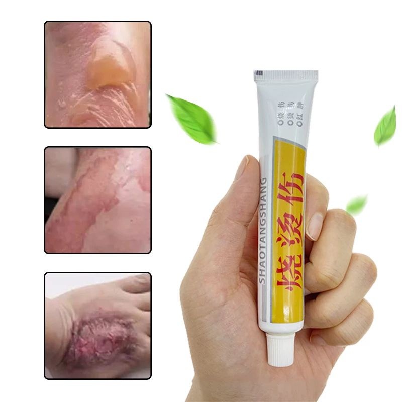 Obat Salep Krim Luka Bakar Melepuh Kutil Kunat Original 100% Huatuo Herbal Tradisional Cina Kena Air Panas Terkena Api Kulit  Menghilangkan Ampuh Keloid OC7