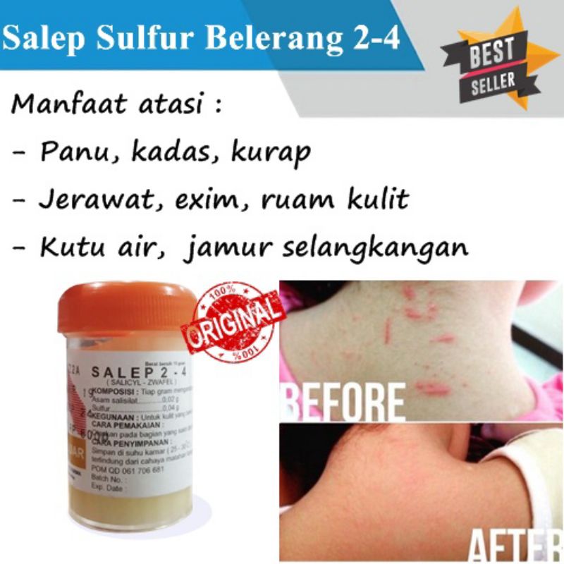 [ bisa COD] ~ OBAT SALEP SULFUR BELERANG BPOM Untuk KADAS KURAP EXIM JAMUR