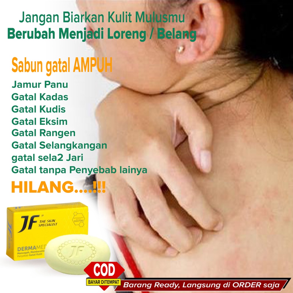 Best Seller Sabun Panu Pembersih Panu jamur Kulit Kadas Kudis Eksim Penghilang gatal Biang Keringat 