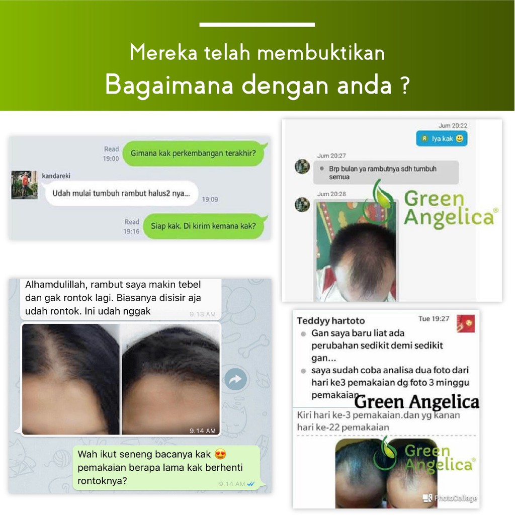 Penumbuh Rambut Cepat Aman Pria Wanita Menumbuhkan Rambut Botak Karena Berbagai Faktor