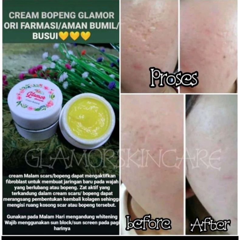 CREAM BOPENG GLAMOR