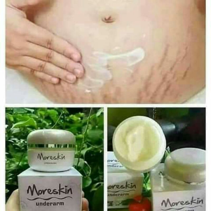 

moreskinunderarm