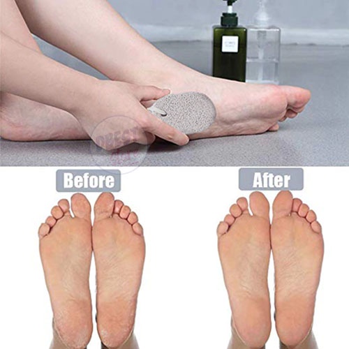 PROMO!! Batu Apung Untuk Kaki - Batu Gosok Kaki Kulit Halus Remover Pedikur Alat untuk Kaki [51gr]