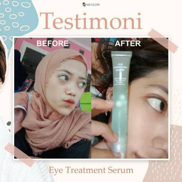 Eye cream / cream mata ms glow / eye dark cream