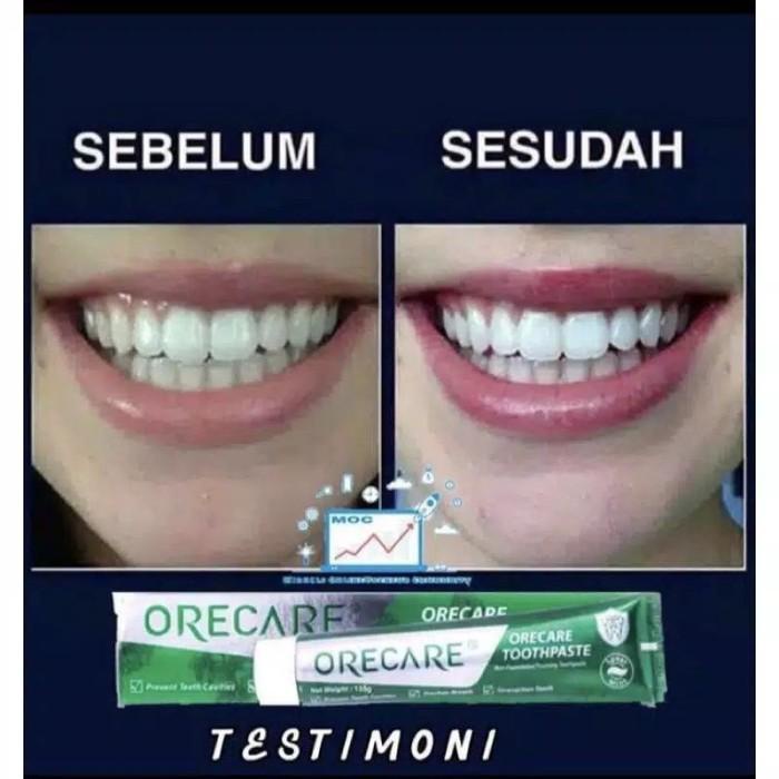 Pasta Pemutih Gigi Orecare Odol Penghilang Karang Ampuh original