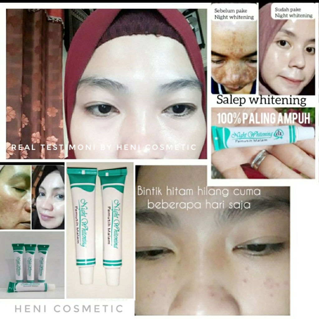 Liz Whitening Salep Flek Hitam BPOM