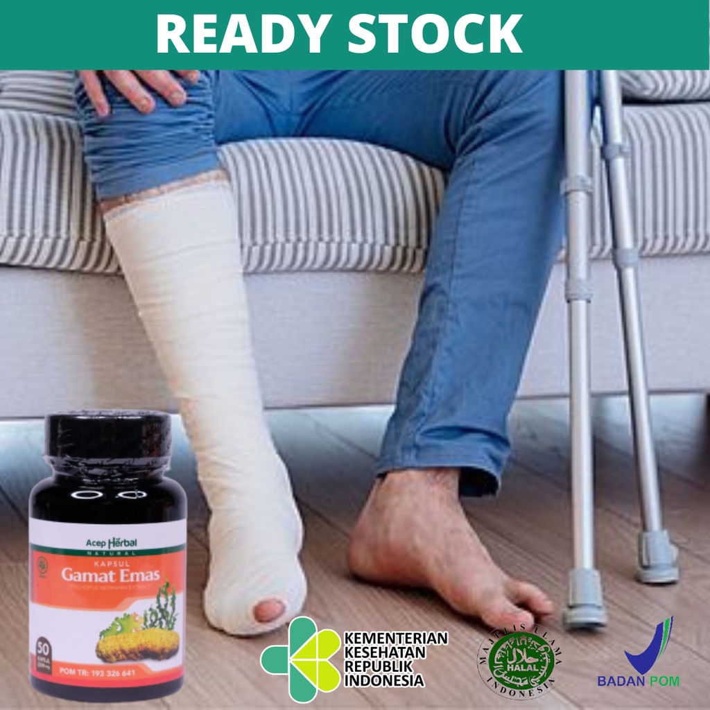 Obat Patah Tulang, Obat Tulang Bergeser, Tulang Retak, Pengapuran Tulang, Osteoporosis, Obat Sambung