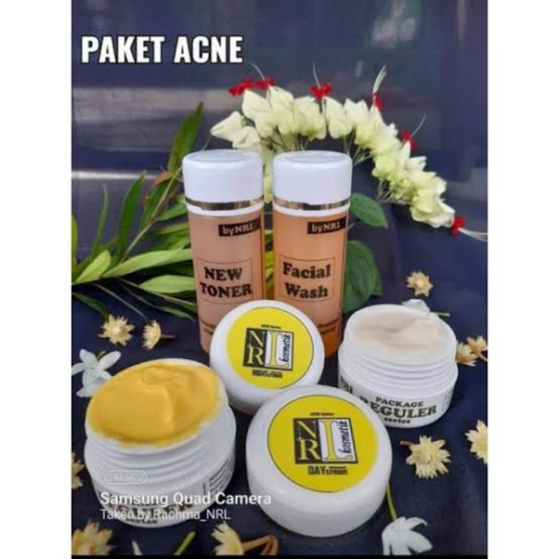 Cream NRL Acne Series Original 100% | Mengatasi jerawat dan bopeng
