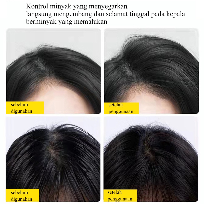 Semprotan Rambut Kering 150ml Semprotan kontrol minyak rambut kering kurungan tersedia Suatu keharusan bagi orang malas penghilang minyak Bedak padat bedak tabur