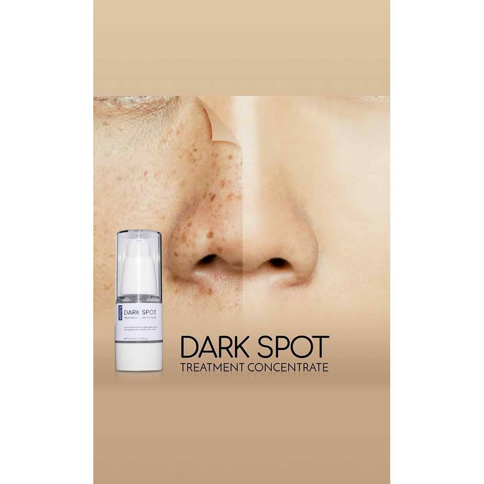 Toner Pelicin Extra Lemon / DARK SPOT ERTOS / SERUM FLEK NODA HITAM ERTO'S