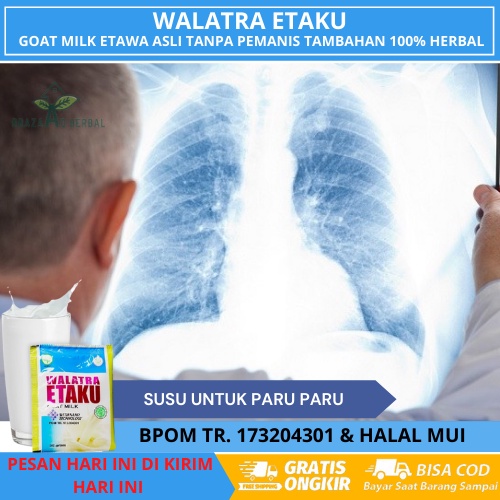 

Susu etawaku untuk paru paru, Obat paru paru basah, susu kambing walatra etaku, susu etaku asli original, etaku goat milk, susu kambing etawa asli, susu kambing etaku, goat milk susu kambing - susu etawa platinum original