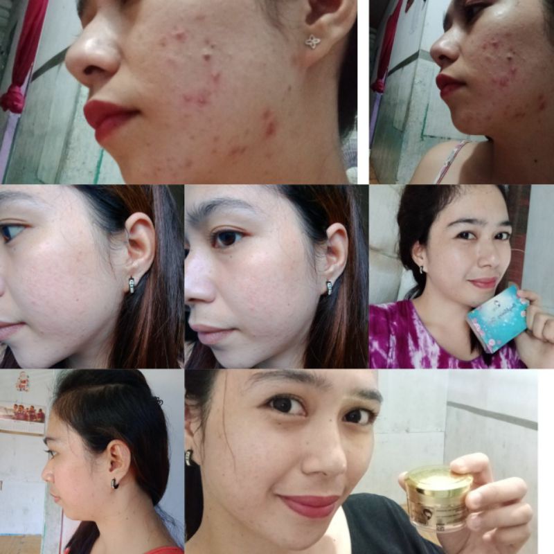 (PROMO ) Sabun Pemutih Wajah Kedas Beauty Original, Sabun Kedas  Beauty ORI,Sabun kedas,Sabun kedas 