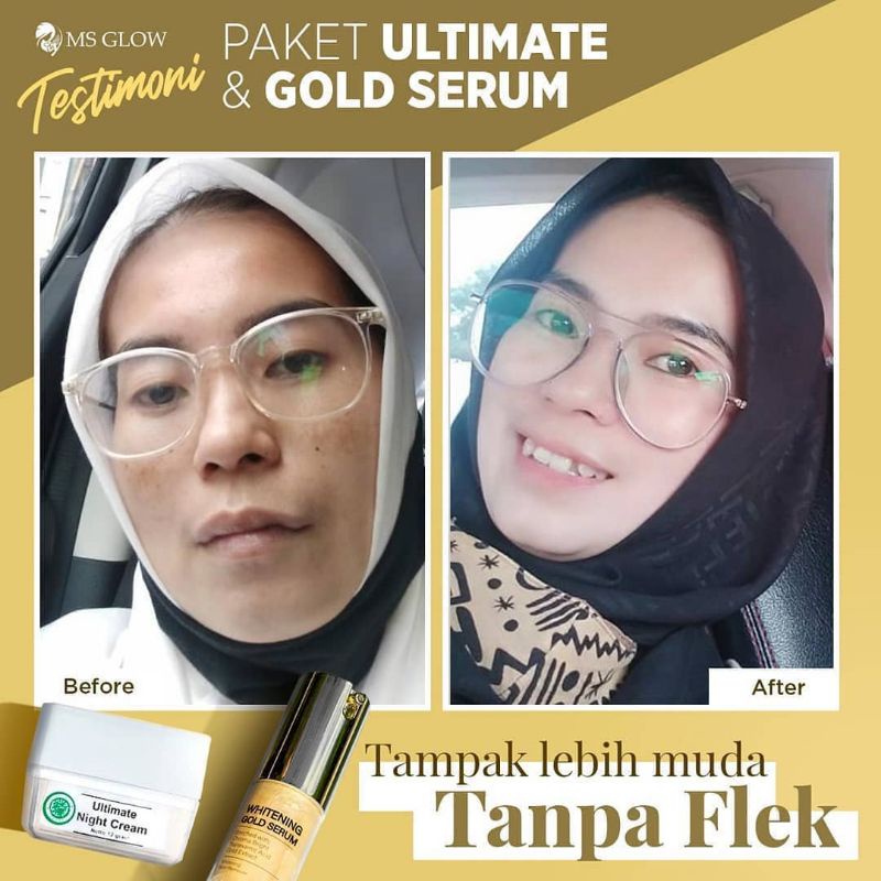 WHITENING GOLD SERUM MSGLOW, SERUM FLEK NODA HITAM SERUM SULTAN ANTI AGING