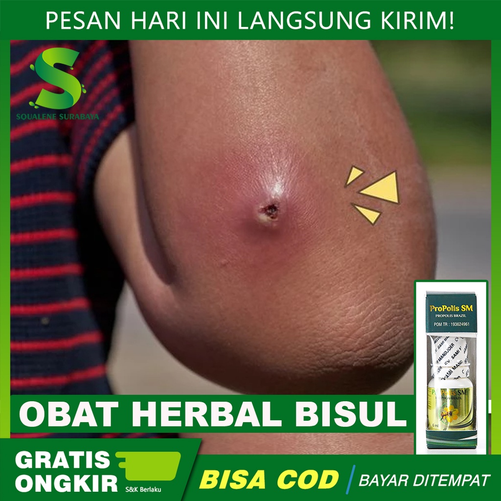 Obat Bisul - Obat Pereda Bisul - Bisul di Ketiak - Selangkangan - Bisul di Pantat - Bisul Membesar d