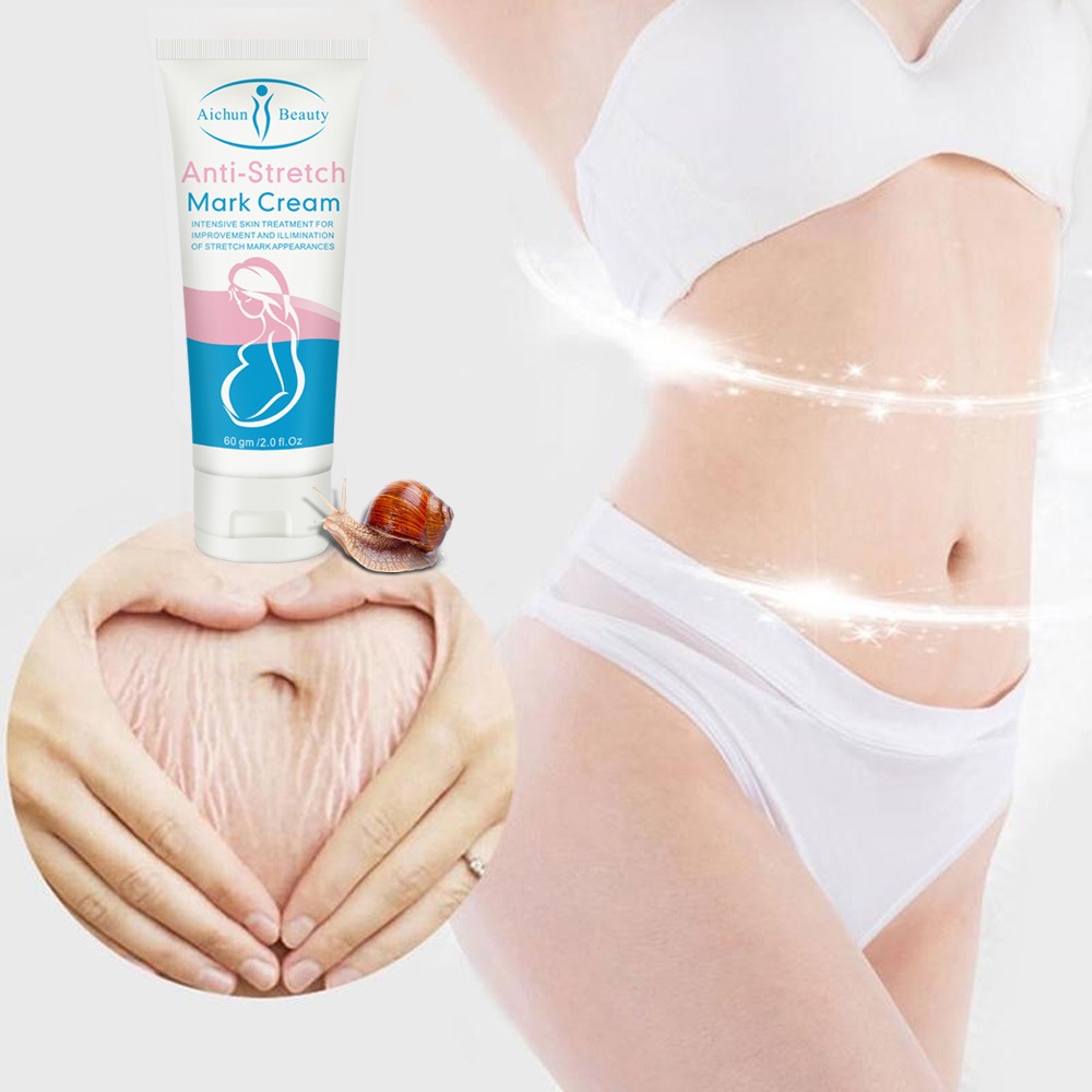 Anti Stretch Mark Cream AICHUN BEAUTY Stretch Mark Removal Bekas Luka Perbaikan Cream Stretch Mark Removal Perawatan Bekas Luka 60g body lotion, pelembab kulit, menghidrasi dan mengangkat