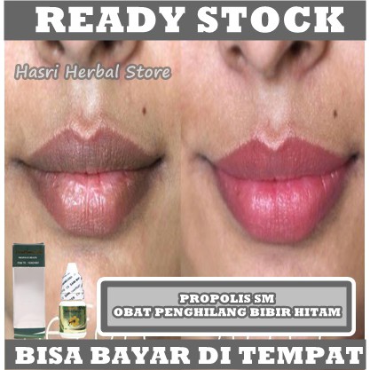 PEMERAH BIBIR / PELEMBAB BIBIR / PENGHILANG BIBIR HITAM / PELEMBAB BIBIR KERING / BIBIR PECAH PECAH / BIBIR PINK / BIBIR HITAM / BIBIR KERING / SERUM BIBIR / OBAT BIBIR KERING / OBAT BIBIR PECAH / PROPOLIS SM BRAZIL