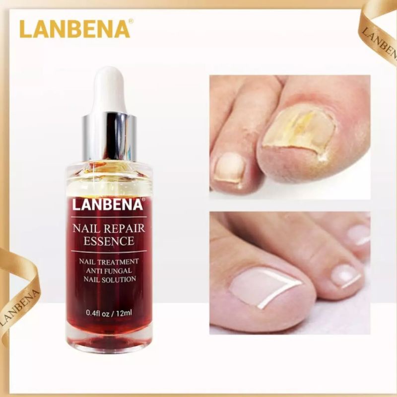 LANBENA NAIL REPAIR SERUM PERAWATAN KUKU KAKI TANGAN ANTI FUNGAL SERUM ESSENCE MEMPERBAIKI KUKU KAKI RUSAK-12ml