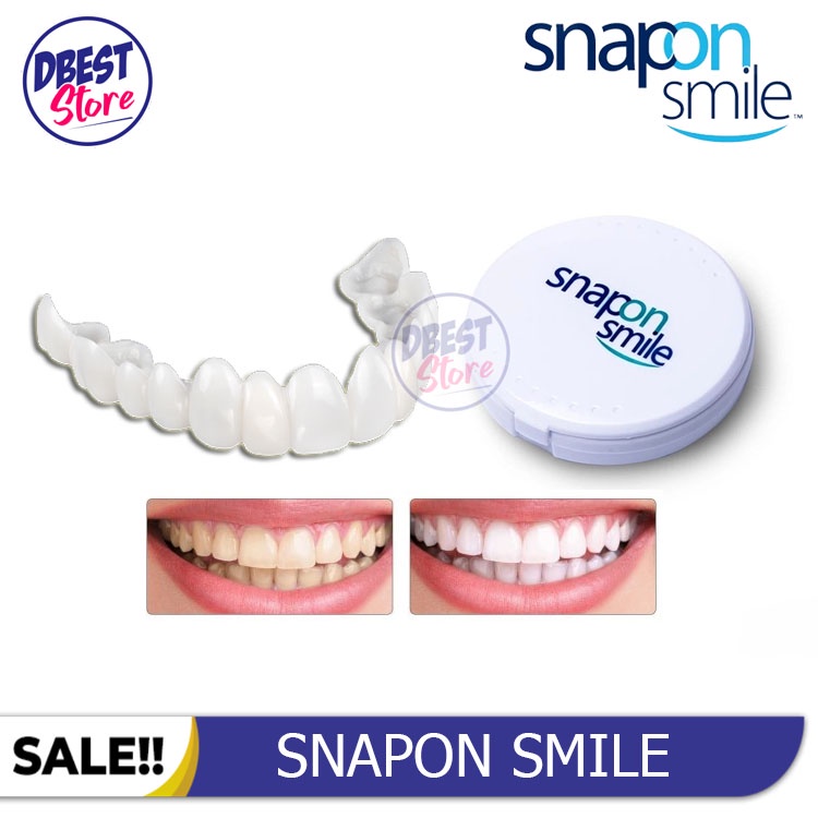 [ BAYAR TEMPAT ] ORIGINAL 100% SNAP ON SMILE SEPASANG GIGI PALSU ATAS BAWAH LEPAS PASANG