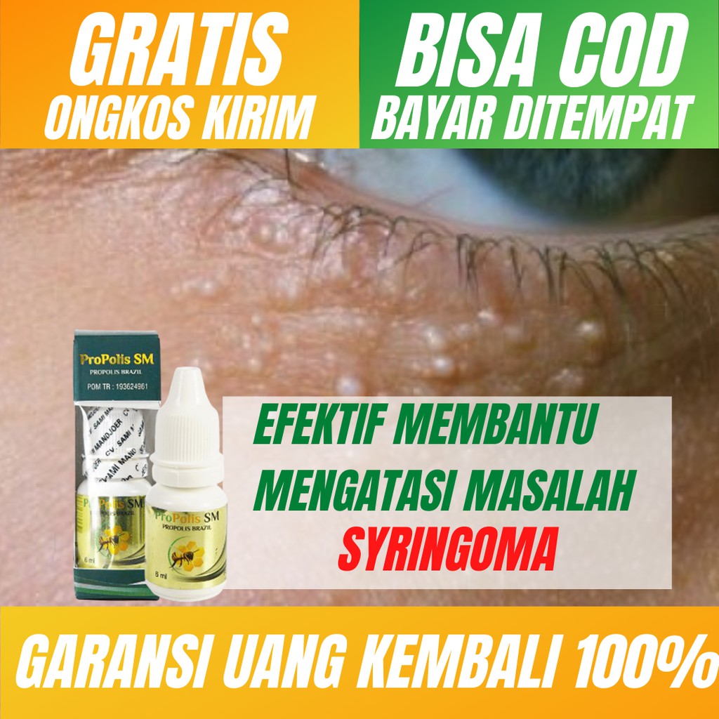 Obat Untuk Menghilangkan Syringoma_Obat Tumor Jinak_Obat Benjolan Kecil_Propolis SM ASLI