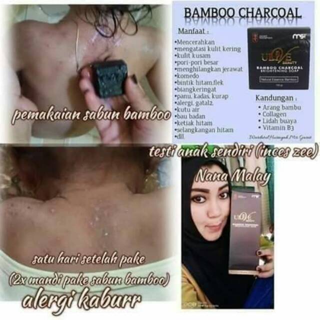 Kulit Kering Setelah Pakai Sabun Bamboo Englshji