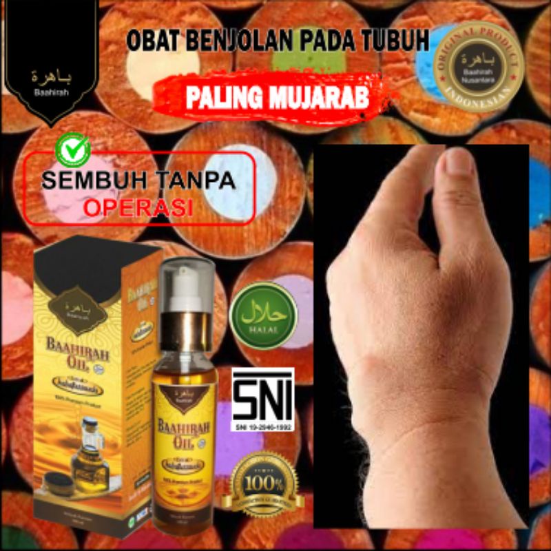 (TERLARIS) BAAHIRAH OIL MENGHILANGKAN SEGALA JENIS BENJOLAN KISTA, LIPOMA, KANKER, DLL