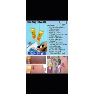 PrimeSkin/penghilang bekas luka/knalpot/hitam pada ketiak