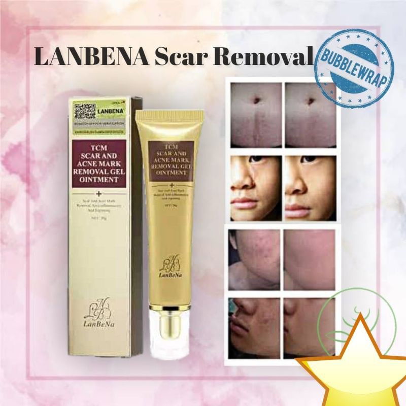 Ready Stock 100% Origonal Lanbeba penghilang bekas jerawat luka scar remover