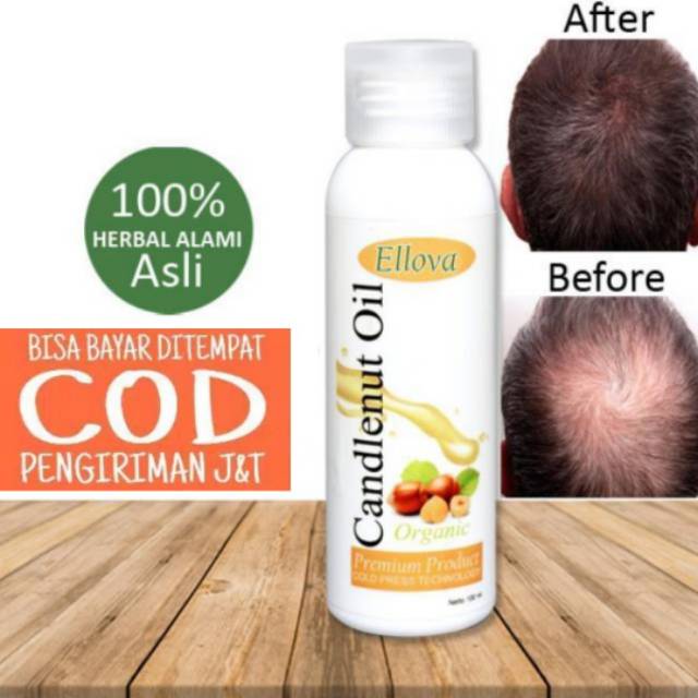 Ellova Kemiri Vitamin Penumbuh Rambut Anak Pria Wanita Ellova Kemiri Vitamin Penumbuh Rambut Anak Pria Wanita