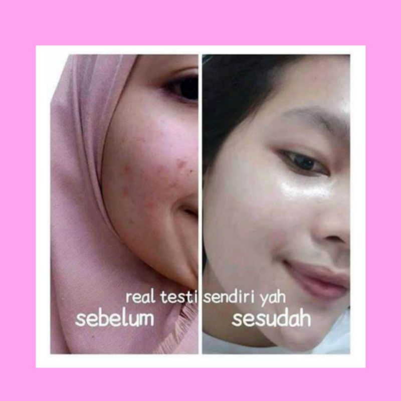 TERMURAH SABUN SAFRON ASLI BPOM ORIGINAL TERLARIS PEMUTIH WAJAH DAN PENGHILANG FLEK HITAM AMPUH