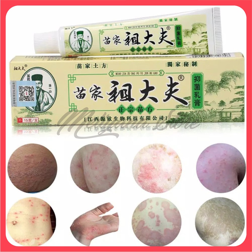 ZUDAIFU Salep Herbal Eczema Cream Eksim Psoriasis Jerawat Ruam Jamur Kudis Kurap