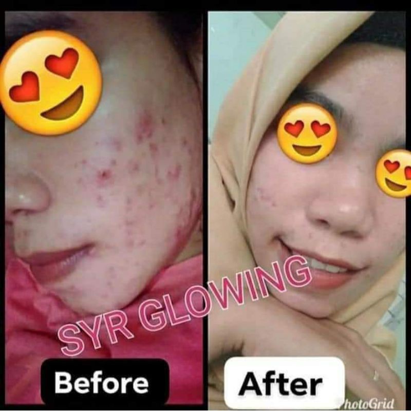 BISA COD BPOM Skincare SABUN FACIAL WASH PAKET LENGKAP SYAHRENI GLOWING syr ORIGINAL syahraeni wajah-5