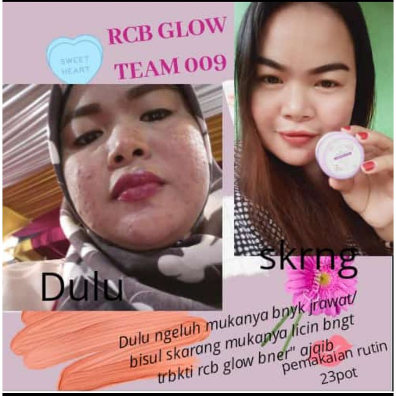 FREE GIFT - Original BPOM PAKETAN rcb glow + pouch cantik