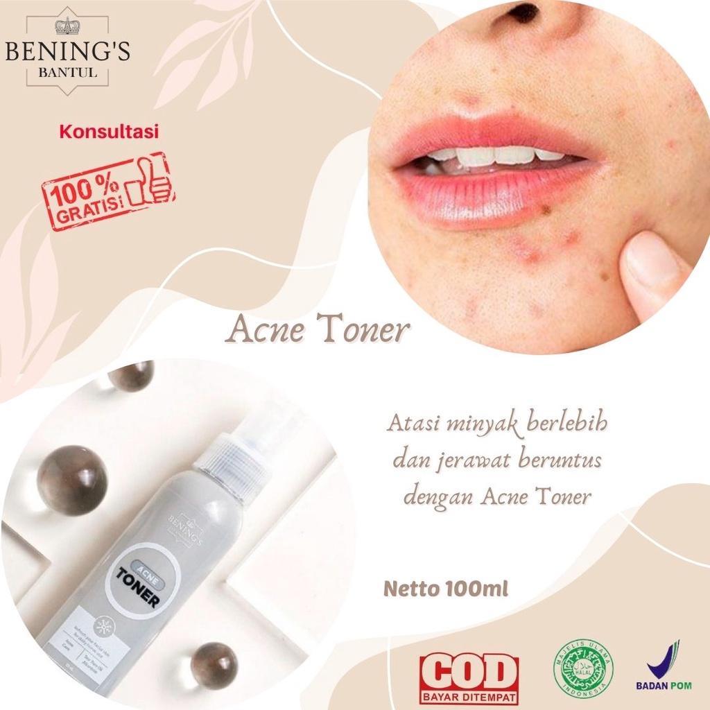 Toner Penghilang Bekas jerawat Obat Jerawat dan Bekas Jerawat Toner Wajah Perawatan Wajah Berjerawat