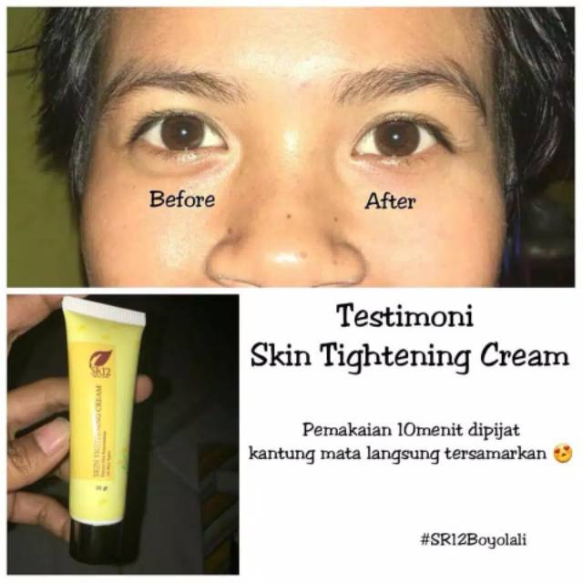 TIGHTENING CREAM SR12 / WHITENING TERBAIK / PENCERAH WAJAH / PENGENCANG ANTI KERUT WAJAH / HERBAL TIGHTENING CREAM SR12 / Krim hilangkan kerutan dalam 10 menit  Skin Tightening krim sr12