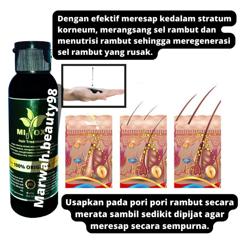 [Paket 3] MINOX Penumbuh Rambut Botak &amp; Rontok Paling Ampuh &amp; Cepat Original 100 ML