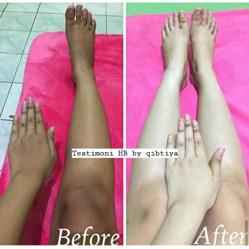 HB LENGKAP (3PCS) SABUN, LOTION PAGI, LOTION MALAM. DOKTER ITA