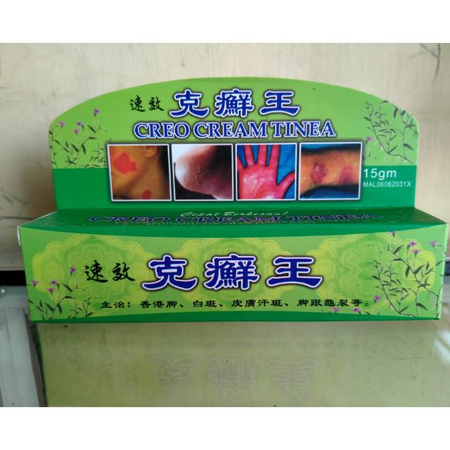 Zi Xian Gao krim anti jamur ( Cream Tinea )