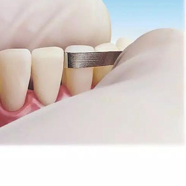 ✼ slicing ortho horico grinding steel strips kikir gigi manual dental abrasive strip ➢